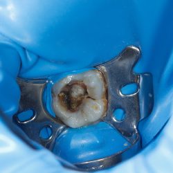 Ade Atención Dental Especializada En Endodoncia