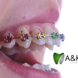 A&k Dent Odontologia Integral