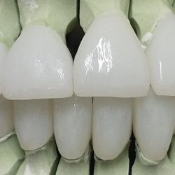 Algodones Dental Guide