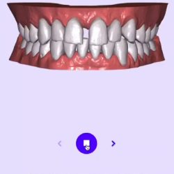 Allineatori Dental Services
