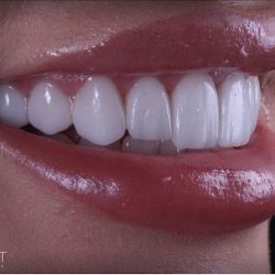 Almont Dental