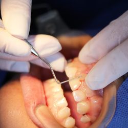 Ap Dental Odontologia Integral