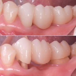 Aqua Clínica Dental (ramos Arizpe)