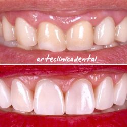 Arte Clinica Dental