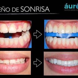 Áurea Dental