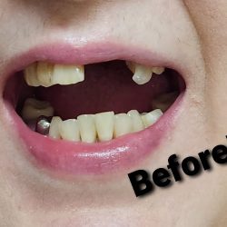 Avila´s Dental Group