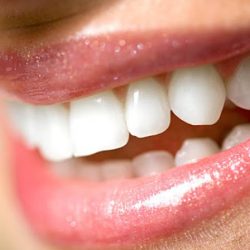 Baja Norte Dental