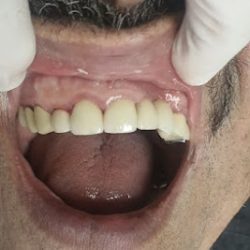 Bc Tijuana Clinica Dental Familiar Osonu