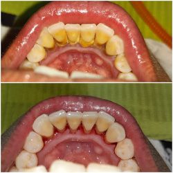 Biodent Clinic Consultorio Dental Dra. Celina Ayala