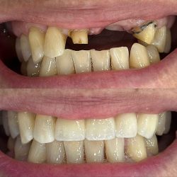 Biodental