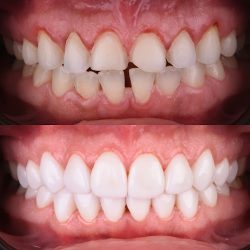 Biodental