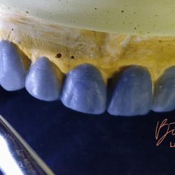 Bite Ki Dental