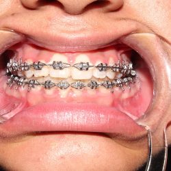 B&m Dental