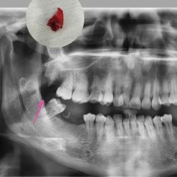 C. L. Dental- Odontóloga Coacalco