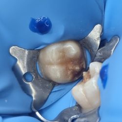 Cabo Smile Design, Odontologia Familiar.