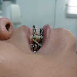 Caedent Clinica De Atención Y Especialidades Dentales