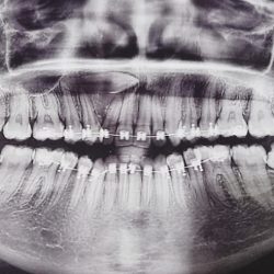 Cealdental