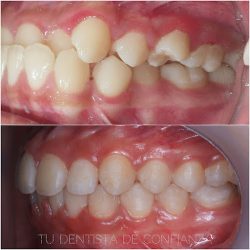 Cedenti - Tu Dentista De Confianza