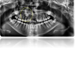Cefalometrics Centro Radiologico