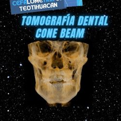 Cefalometrix México Teotihuacán