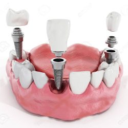 Centro Dental Jeda