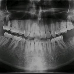 Centro RadiolÓgico Dental