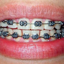 Ceon Dental Dr. Noel Cerda Ochoa
