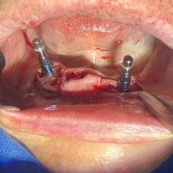 Cirujano Dentista Alejandra Alvarez Hdez.