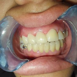 Cirujano Dentista Dra. Ma. Martha Mendoza C.