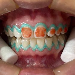 Cirujano Dentista, Especialista En Ortodoncia Y Ortopedia Maxilar, Celia Gallegos Facio