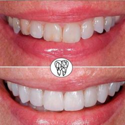 Clínica Arte Dental, Pitillal.