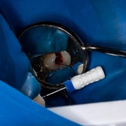 Clínica Dental Bf