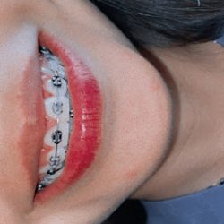 Clinica Dental Bonita Smile