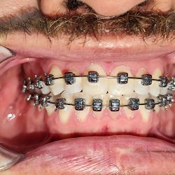 Clínica Dental Bracket-in ( Terranova) & Spa