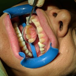 Clinica Dental Carmona