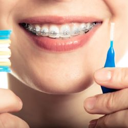 Clínica Dental Coacalco Dentista - Ortodoncia