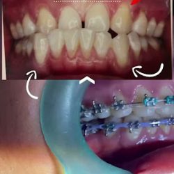 Clinica Dental - Dentaliz (dentalli) - Ortodoncia - Dentistas En Ometepec - Dentistas Guerrero