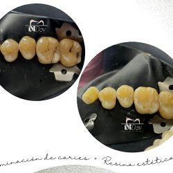Clinica Dental Didav-centro
