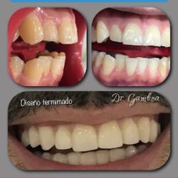 Clínica Dental Dr.gamboa