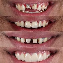 Clinica Dental Especialidades OdontologÍcas Dr. Erick BazÁn Beristain