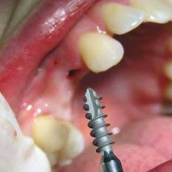 Clínica Dental Funnydent ( Dentistas En Matamoros )