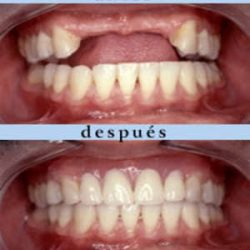 Clinica Dental MÉxico