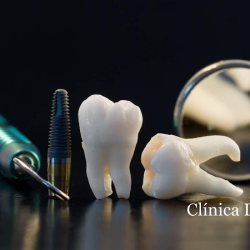 Clinica Dental Mg Celaya