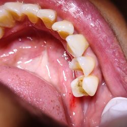 Clínica Dental Miranda (previa Cita)