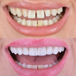 Clínica Dental Nuevo Nogales