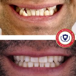 Clínica Dental Pierre Celaya