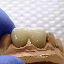 Clínica Dental Ribera Del Lago, Dentista En Jocotepec