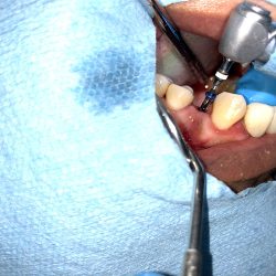 Clinica Dental San Jose