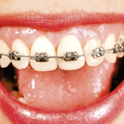 Clínica Dental San Leo