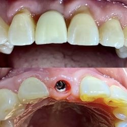Clínica Dental S&f: Ortodoncia, Odontología Integral,cirugía Bucal, Ortopedia, Implantes Dentales